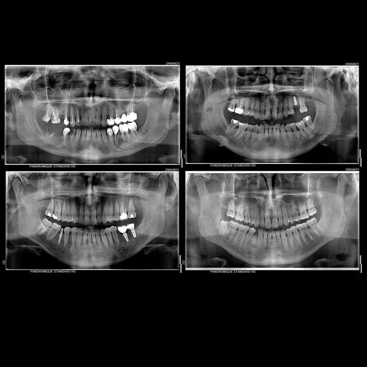 Owandy I-Max PRO Wall-Mounted Digital Pan Unit Dental Panoramic System
