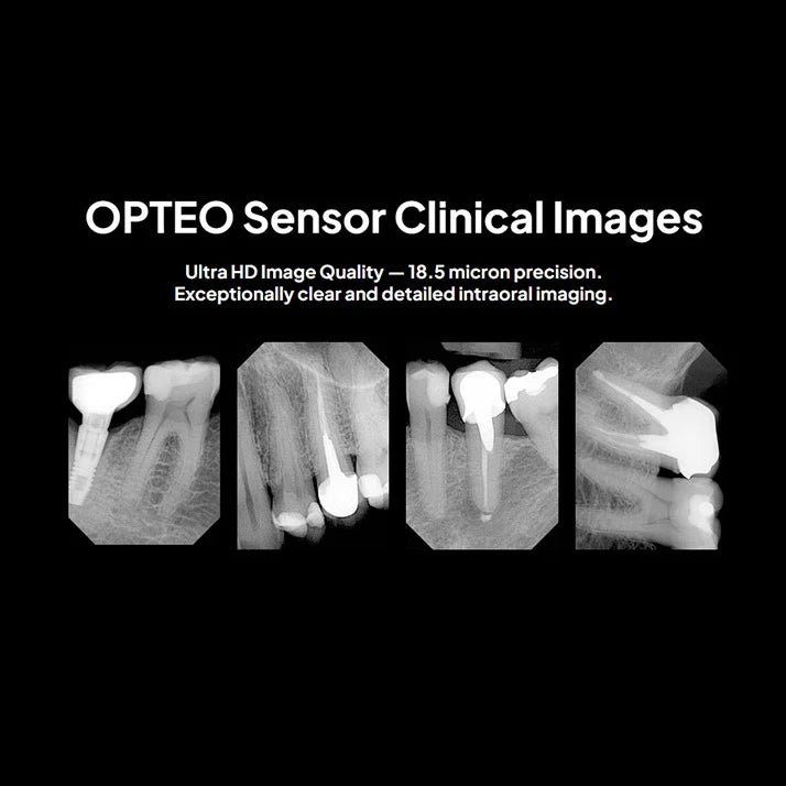 Owandy OPTEO Digital Intraoral Sensor Three Sizes for High-Resolution Dental Radiography